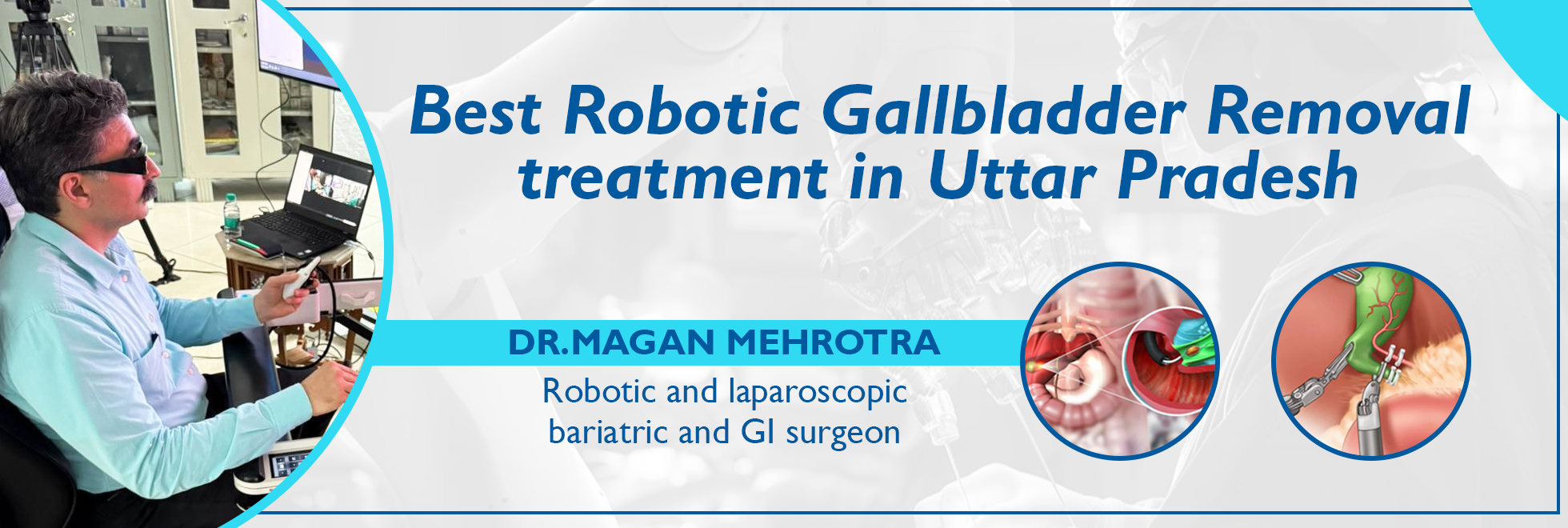 Robotic Gallbladder